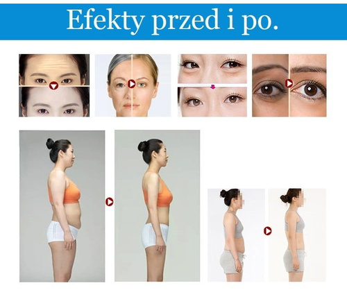 Radio Frequency Radio MINI RF Lifting Wrinkles Cellulite