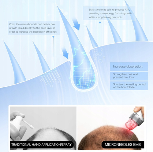 Bio Pen Q2 – dermapen 4w1 z EMS, terapią LED i mikroigłowaniem MTS + 2 kartridże
